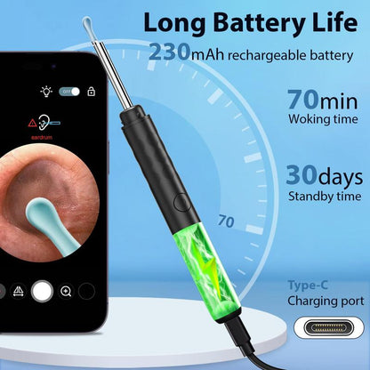 Ear Wax Removal Tool, Ear Cleaner Camera with 1296P, Ear Cleaning Kit with 6 Ear Pick, Ear Camera for Iphone, Ipad, Android Phones, with 8 Pcs Ear Set